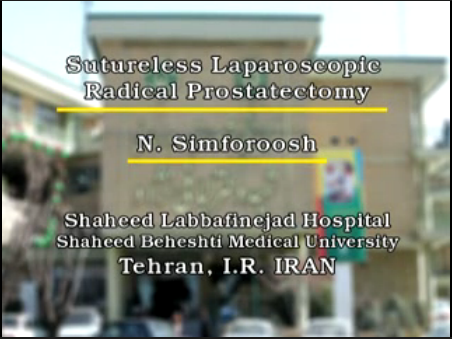 رادیکال لاپاروسکوپک پروستاتکتومی بدون استفاده از بخیه